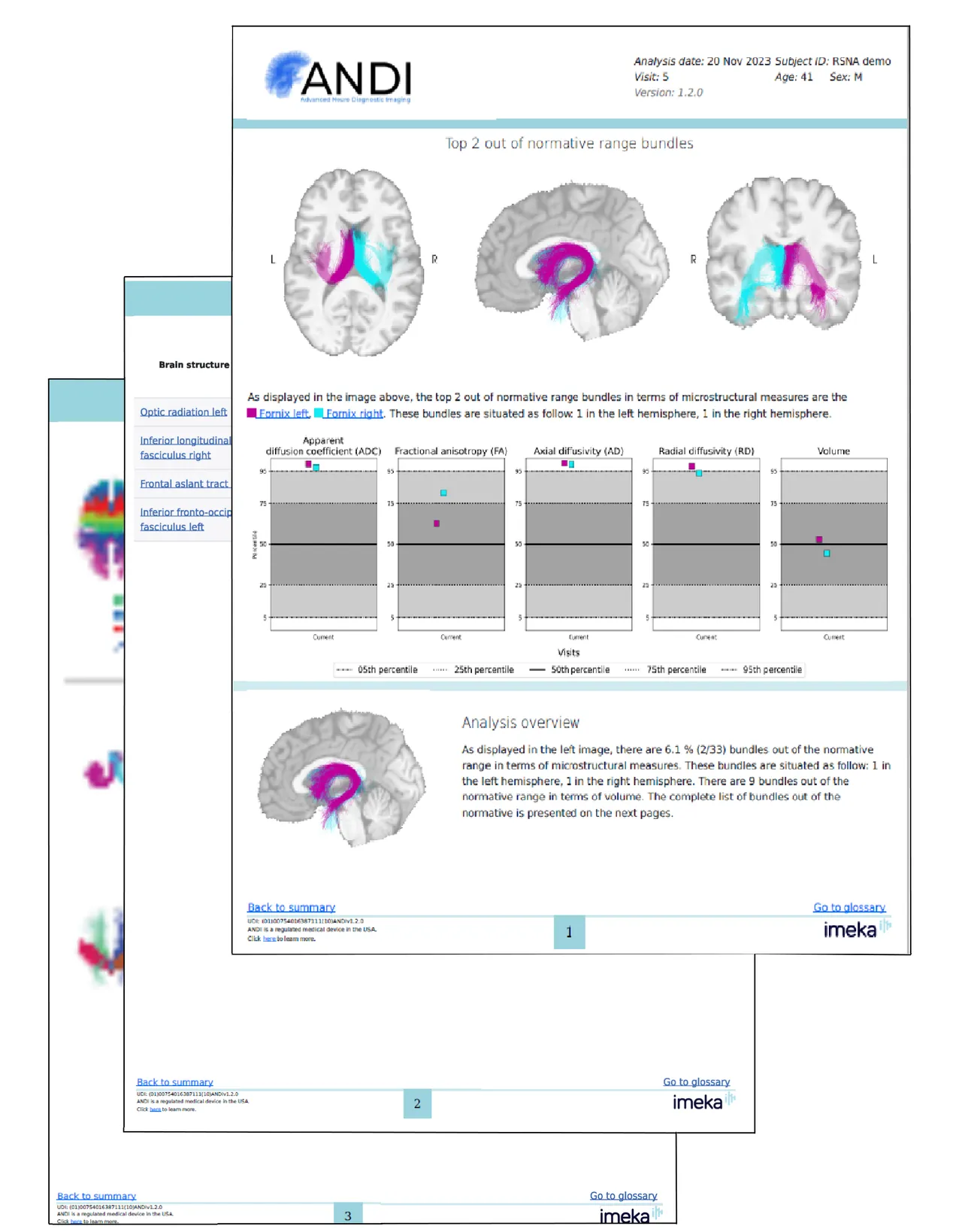 Andi brand asset featured on imeka.ca