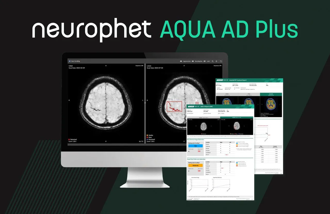Aqua brand asset featured on neurophet.com