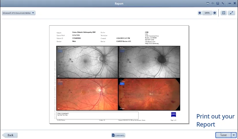 Clarus brand asset featured on zeiss.com