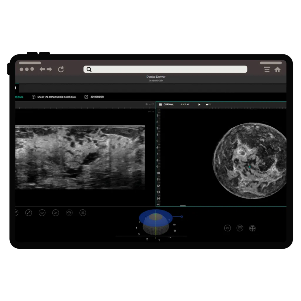 iSono Health brand asset featured on isonohealth.com