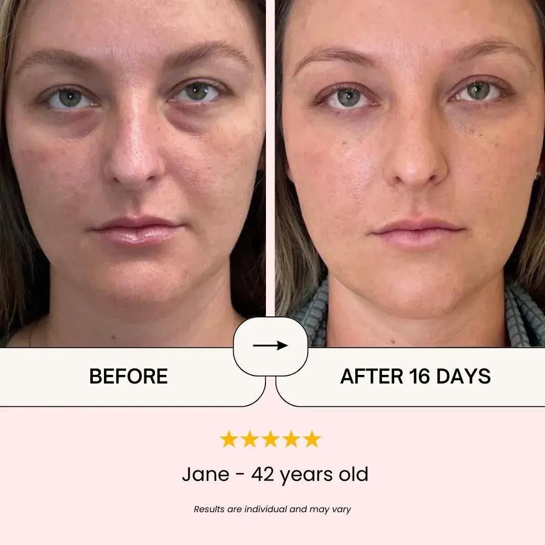 Lumineye brand asset featured on cellenceskin.com