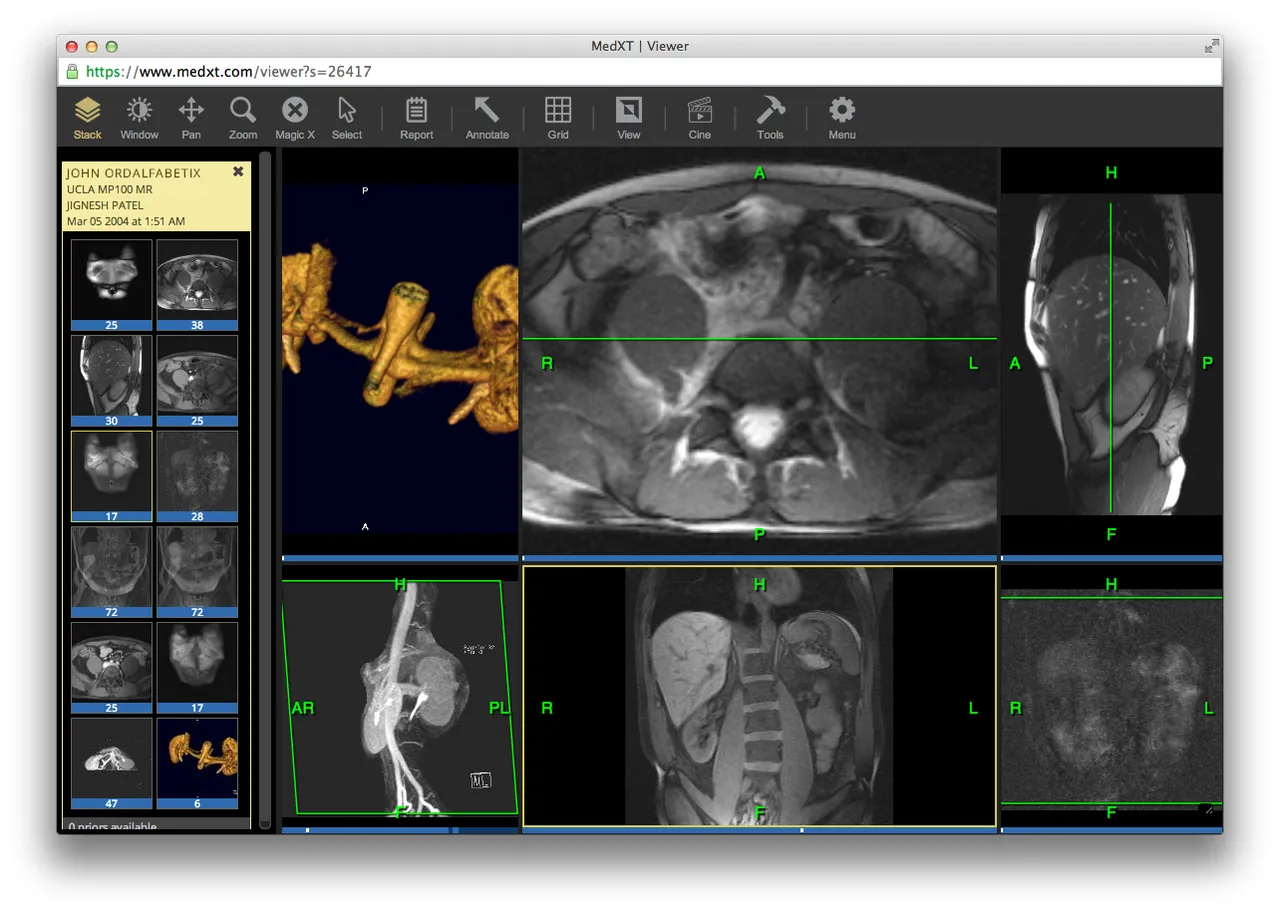 MedXT brand asset featured on itnonline.com