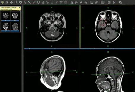 MedXT brand asset featured on itnonline.com