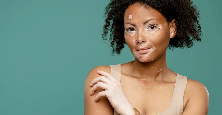 My NextDerma brand asset featured on mynextderma.com