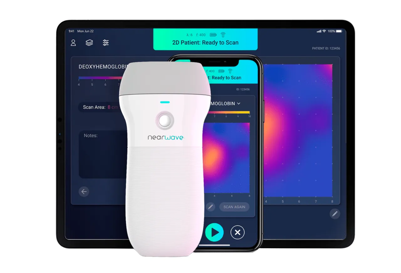 NearWave brand asset featured on nearwave.co
