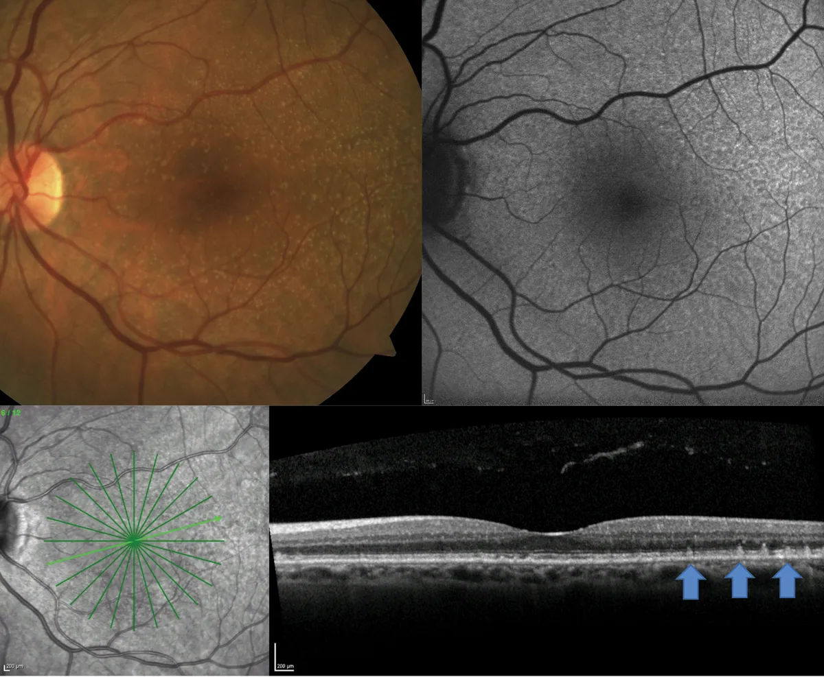 Reticular brand asset featured on reviewofoptometry.com